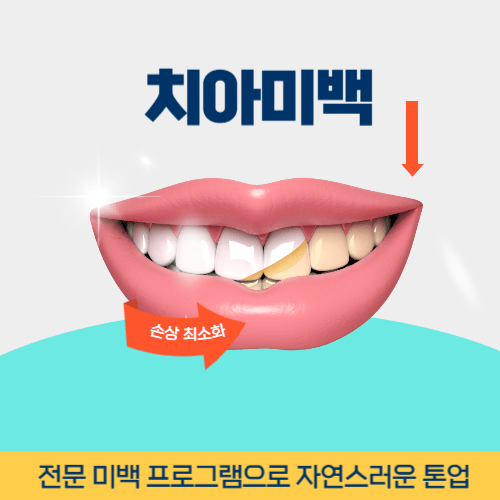 화성치과 화성시 치과 치아미백