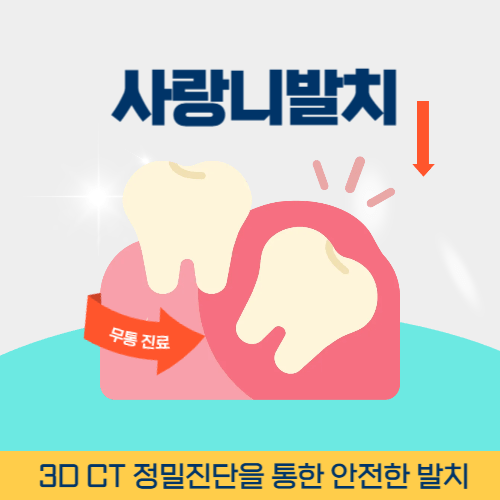 화성치과 화성시 치과 사랑니 발치