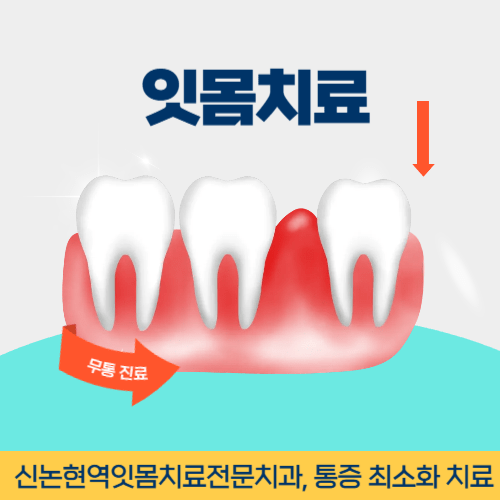 화성치과 화성시 치과 잇몸치료